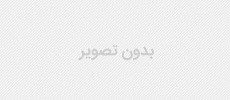 فرکشنال لیزر|لیزر فرکشنال CO2|فراکشنال CO2 لیزر ...