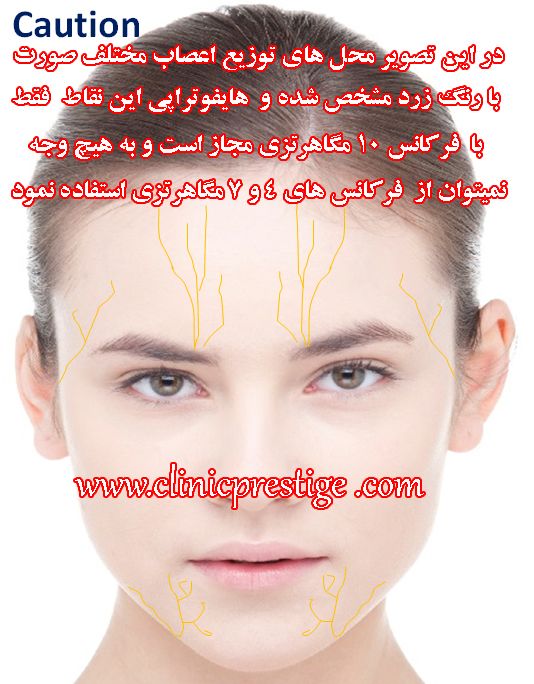هایفوتراپی کشیدن پوست صورت